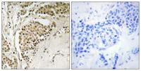 NOM1 Polyclonal Antibody