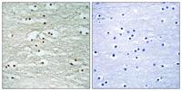Nop132 Polyclonal Antibody