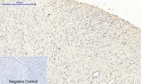 iNOS Polyclonal Antibody