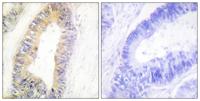 NP220 Polyclonal Antibody