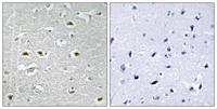 NPA1 Polyclonal Antibody