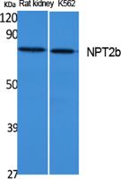 NPT2b Polyclonal Antibody