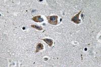 NPY Polyclonal Antibody