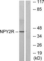 NPY2-R Polyclonal Antibody