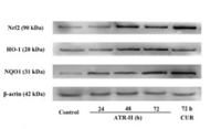 NQO1 Polyclonal Antibody