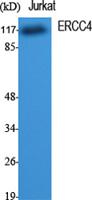 ERCC4 Polyclonal Antibody