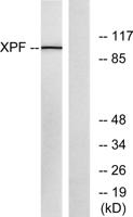 ERCC4 Polyclonal Antibody