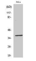 ERdj3 Polyclonal Antibody