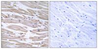 ERdj3 Polyclonal Antibody