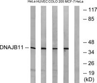 ERdj3 Polyclonal Antibody