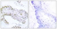 ERF Polyclonal Antibody