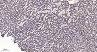 ERGIC-3 Polyclonal Antibody