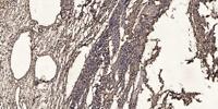 Ribosomal Protein S2 Polyclonal Antibody