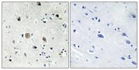 Ribosomal Protein S20 Polyclonal Antibody