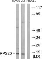 Ribosomal Protein S20 Polyclonal Antibody