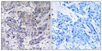 Ribosomal Protein S21 Polyclonal Antibody