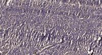Ribosomal Protein S23 Polyclonal Antibody
