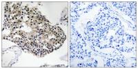 Ribosomal Protein S25 Polyclonal Antibody