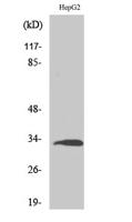 Ribosomal Protein S3 Polyclonal Antibody