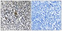 Ribosomal Protein S3 Polyclonal Antibody