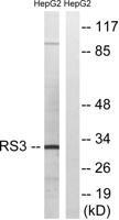 Ribosomal Protein S3 Polyclonal Antibody