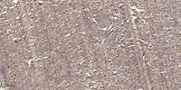 Gab 2 Polyclonal Antibody