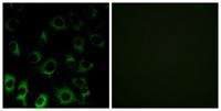 Ribosomal Protein S4X Polyclonal Antibody