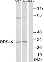 Ribosomal Protein S4X Polyclonal Antibody