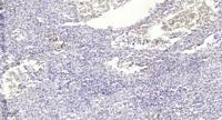 Ribosomal Protein S4X Polyclonal Antibody
