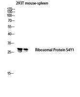 Ribosomal Protein S4Y1 Polyclonal Antibody