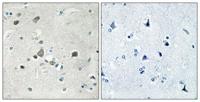 Ribosomal Protein S4Y1 Polyclonal Antibody