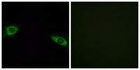 Ribosomal Protein S4Y1 Polyclonal Antibody