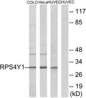 Ribosomal Protein S4Y1 Polyclonal Antibody