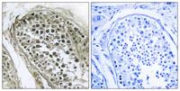 Gab 2/4 Polyclonal Antibody