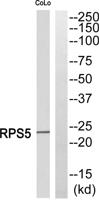 Ribosomal Protein S5 Polyclonal Antibody