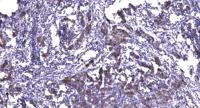 Ribosomal Protein S5 Polyclonal Antibody