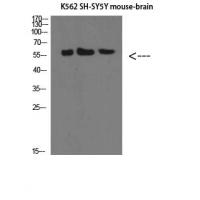 E-Selectin Polyclonal Antibody