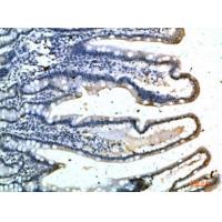 E-Selectin Polyclonal Antibody