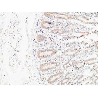 E-Selectin Polyclonal Antibody