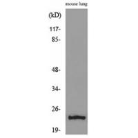 ET-1 Polyclonal Antibody