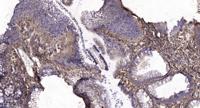 ETAR Polyclonal Antibody