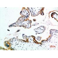 ETBR Polyclonal Antibody