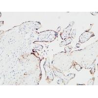 ETBR Polyclonal Antibody