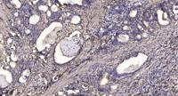 Ethanolamine kinase 2 Polyclonal Antibody