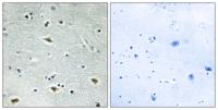 ETO-2 Polyclonal Antibody