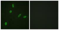 ETS1 Polyclonal Antibody