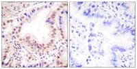 ETS1 Polyclonal Antibody