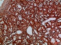 EYA1/EYA4 Polyclonal Antibody