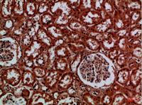 EYA1/EYA4 Polyclonal Antibody