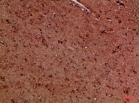 EYA1/EYA4 Polyclonal Antibody